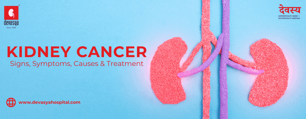 Kidney Cancer: Signs, Symptoms, Causes & Treatment